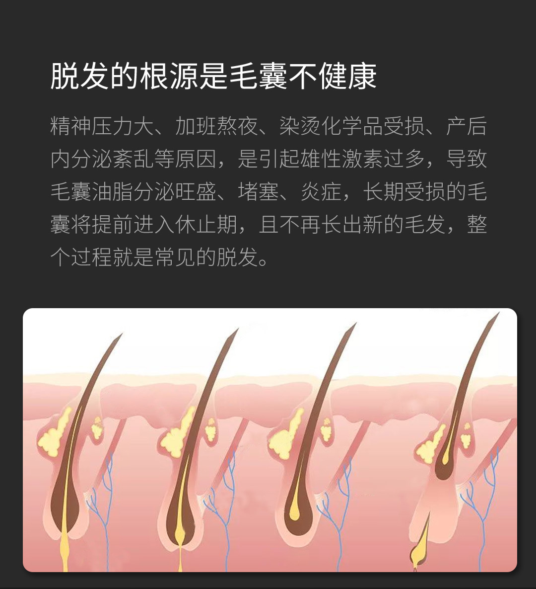 OG-5637 健发梳 | 支持私模开发与品牌定制 |医疗级650nmLLLT照射,可贴牌代工 OG-5637 健发梳 | 支持私模开发与品牌定制 |医疗级650nmLLLT照射,可贴牌代工