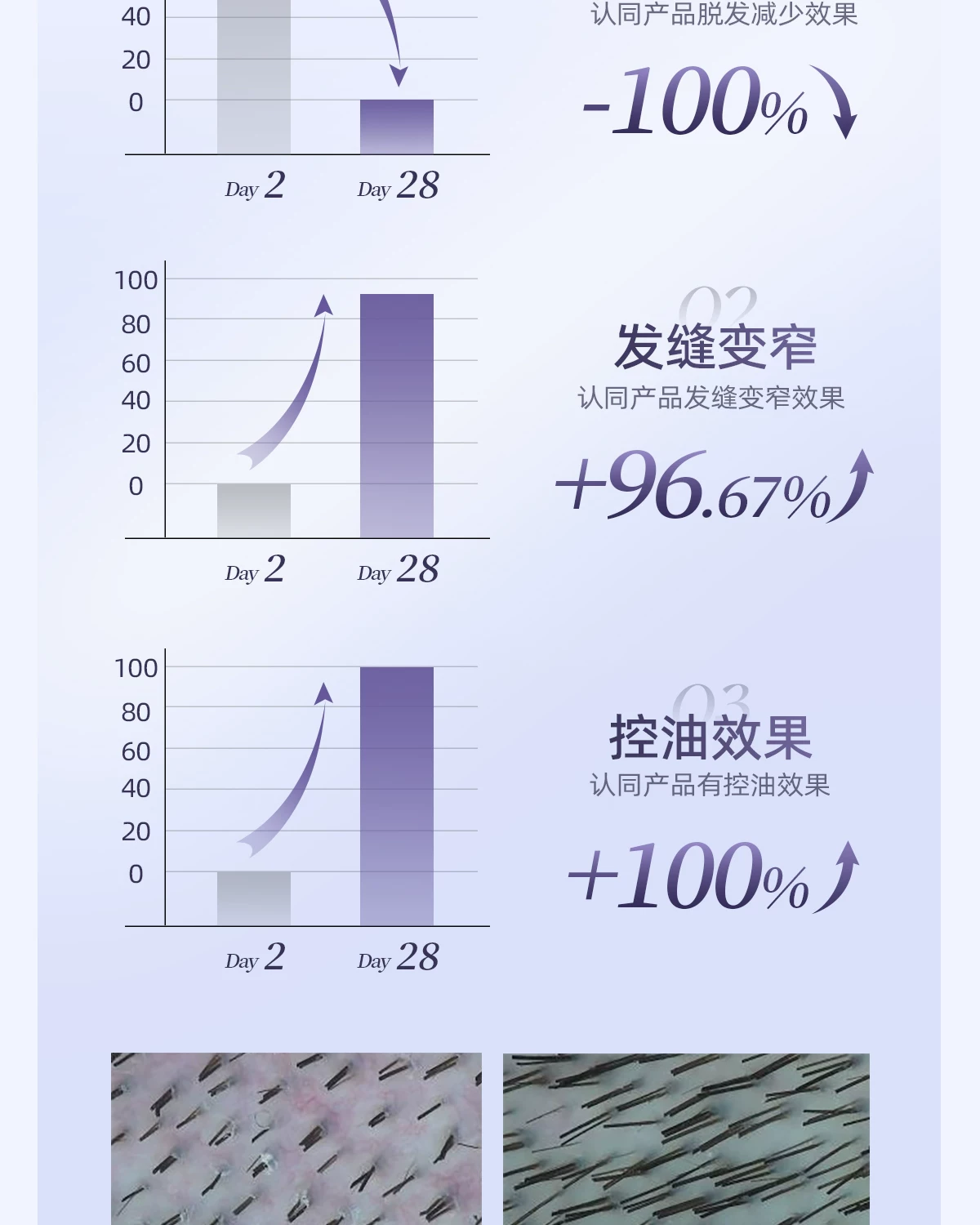 OG-5612 低温等离子健发梳 | 支持私模开发与品牌定制 | 双头梳齿随心切换,可贴牌代工 OG-5612 低温等离子健发梳 | 支持私模开发与品牌定制 | 双头梳齿随心切换,可贴牌代工