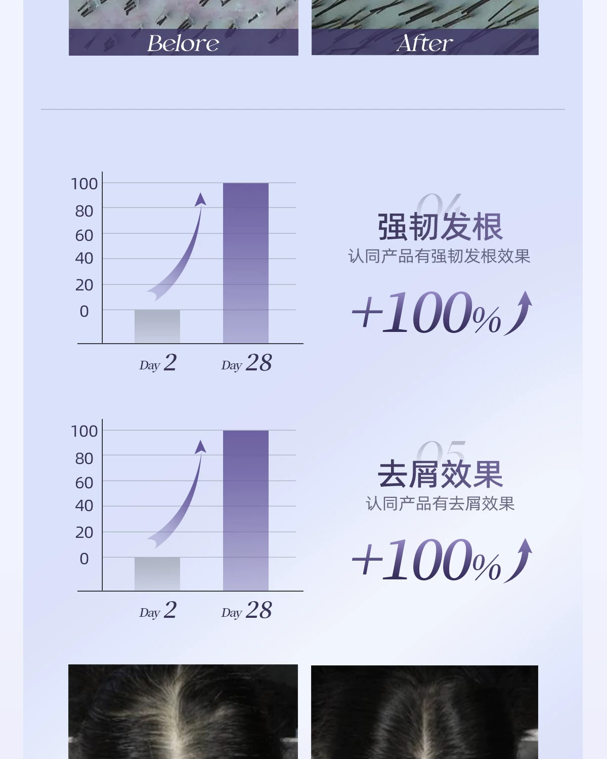 OG-5612 低温等离子健发梳 | 支持私模开发与品牌定制 | 双头梳齿随心切换,可贴牌代工 OG-5612 低温等离子健发梳 | 支持私模开发与品牌定制 | 双头梳齿随心切换,可贴牌代工